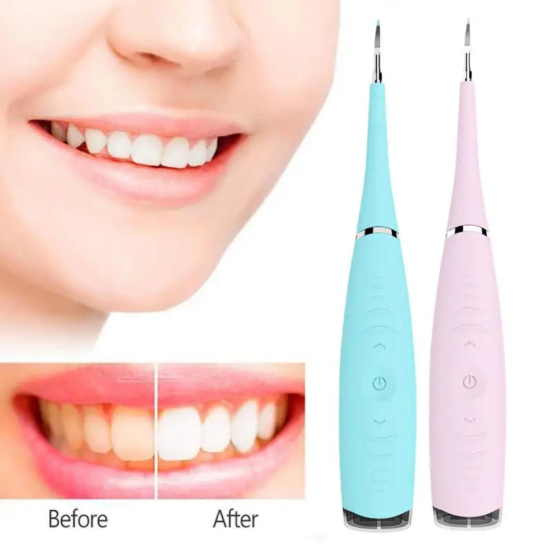 Ultrasonic Tooth Cleaning Wand Electric Ultrasonic Tooth Cleaner Calculus Removal Anti-Slip Oral Care Tooth Cleaning Tool