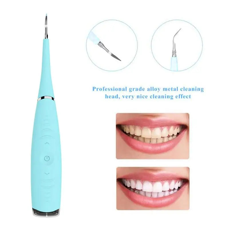 Ultrasonic Tooth Cleaning Wand Electric Ultrasonic Tooth Cleaner Calculus Removal Anti-Slip Oral Care Tooth Cleaning Tool