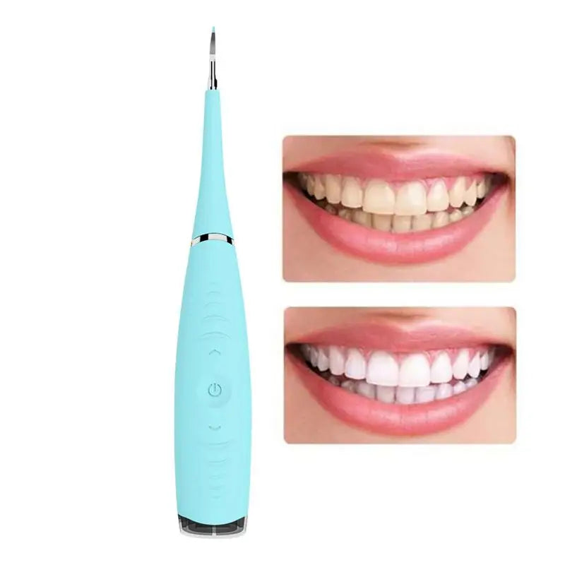 Ultrasonic Tooth Cleaning Wand Electric Ultrasonic Tooth Cleaner Calculus Removal Anti-Slip Oral Care Tooth Cleaning Tool